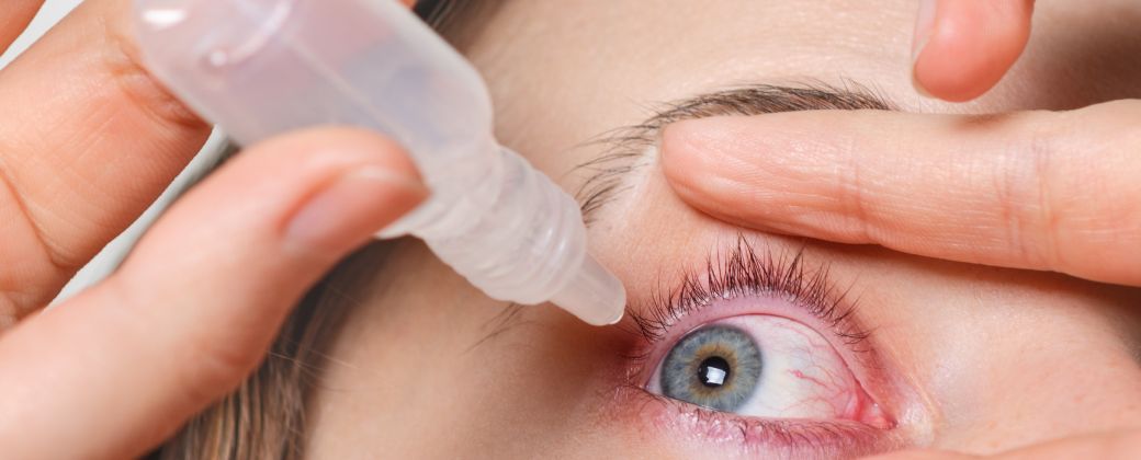 glaucoma מה זה: תקריב, אישה מטפטפת טיפות לעין אדומה עם דלקת הלחמית, גלאוקומה.