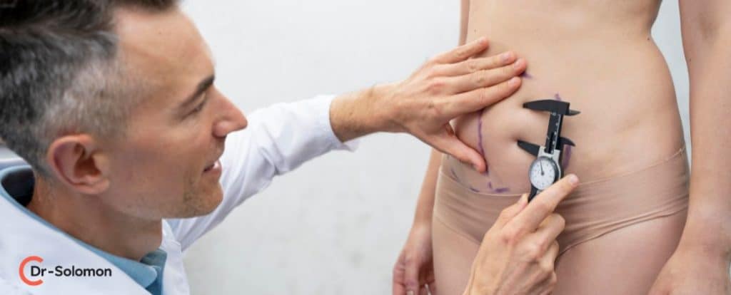 שאיבת שומן מהי ובצד שמאל למטה לוגו אתר dr-solomon